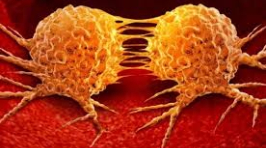 فريق من الباحثين في بريطانيا يتوصل إلى تقنية جديدة لتشخيص أورام الدماغ فريق من الباحثين في بريطانيا يتوصل إلى تقنية جديدة لتشخيص أورام الدماغ