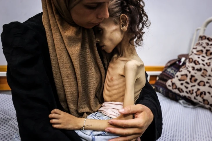 "صحة غزة”: تسجيل 4 حالات وفاة بسبب المجاعة خلال الـ24 ساعة الماضية