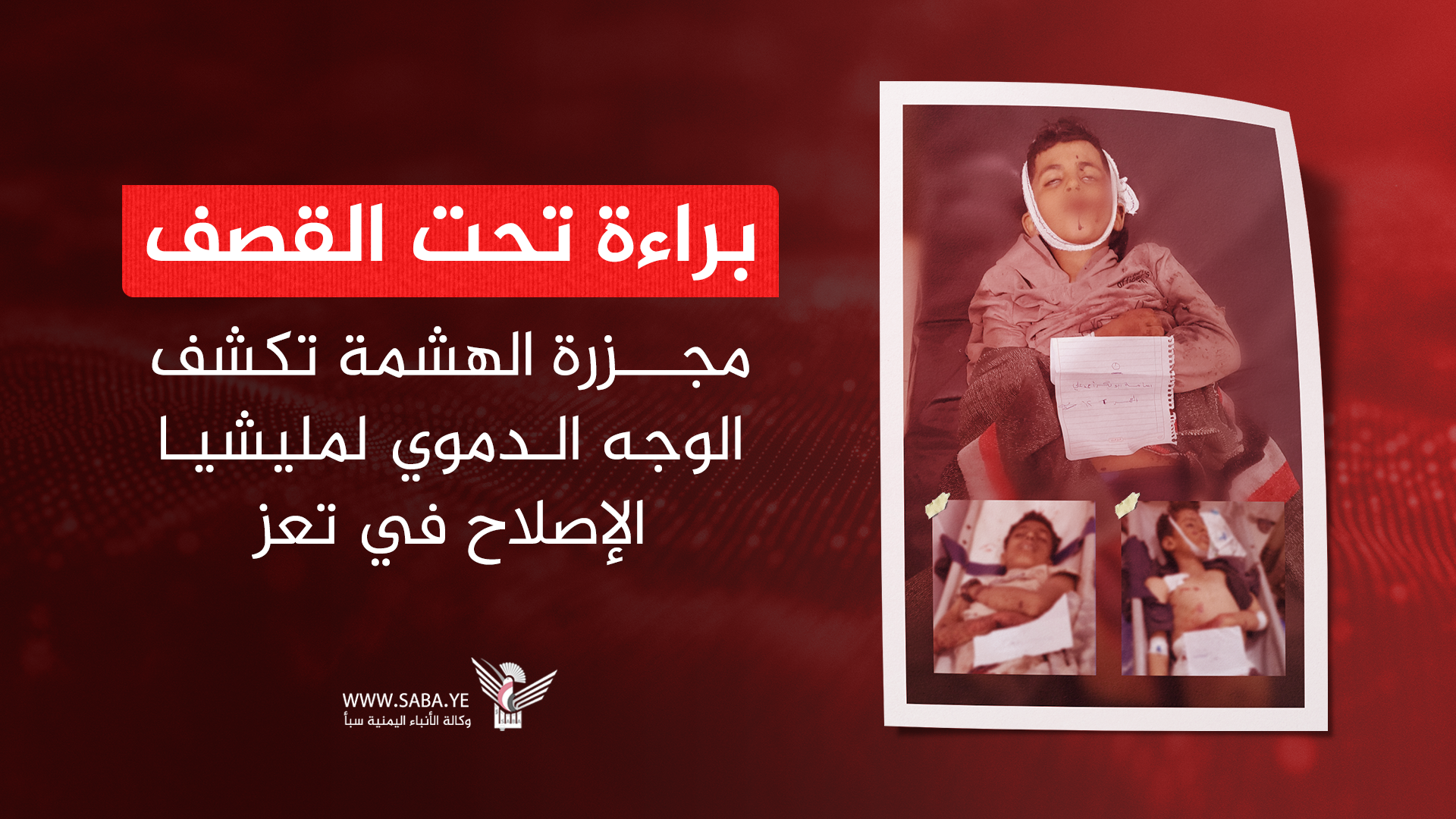 براءة تحت القصف.. مجزرة الهشمة تكشف الوجه الدموي لمليشيا الإصلاح في تعز