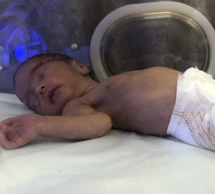 مجمع الناصر الطبي بغزة: وفاة 13 طفلاً بينهم عشرة أجنة  خلال 24 ساعة