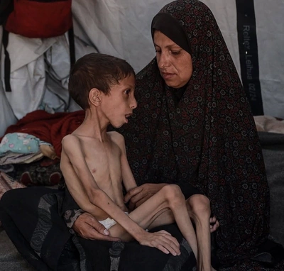 نافذ.. طفل غزاوي في العاشرة حوّلته المجاعة إلى هيكل عظمي