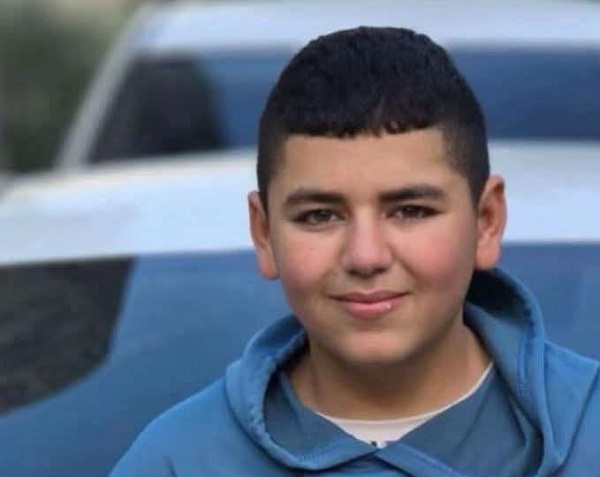 استشهاد طفل فلسطيني متأثرا بإصابته في قصف للاحتلال الصهيوني على قباطية