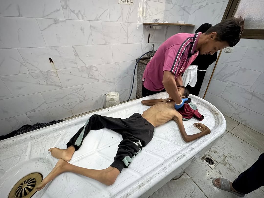 "أونروا": أهالي غزة يموتون نتيجة التجويع الشديد وموظفونا يغمى عليهم