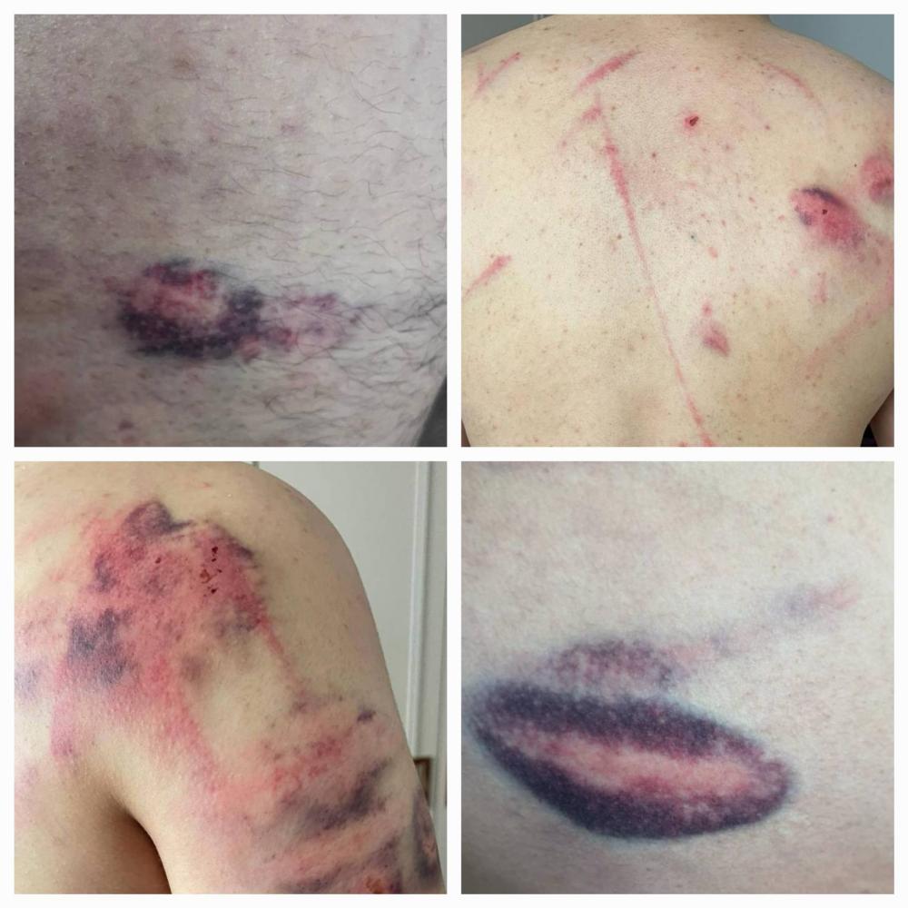 اعلام الاسرى: العدو الصهيوني يعتدي على فلسطيني بذريعة وجود فيديو لغزة على هاتفه