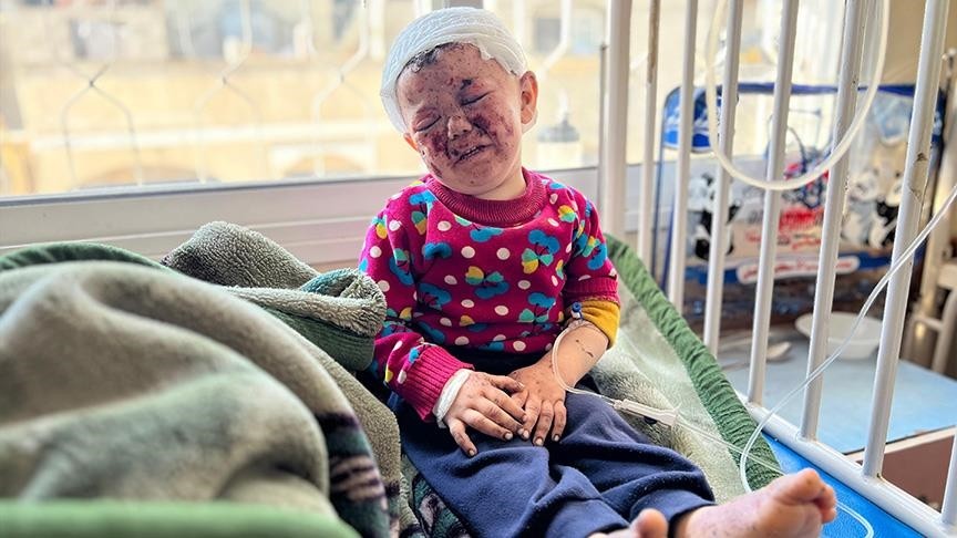 أطباء بلا حدود :العدوان على غزة يتسبب باصابة 100 شخص بحروق يوميا 