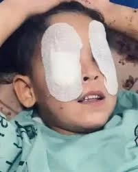 الصحة بغزة: ️آلاف المرضى مهددون بفقدان البصر نتيجة نقص الأدوية والأجهزة الجراحية