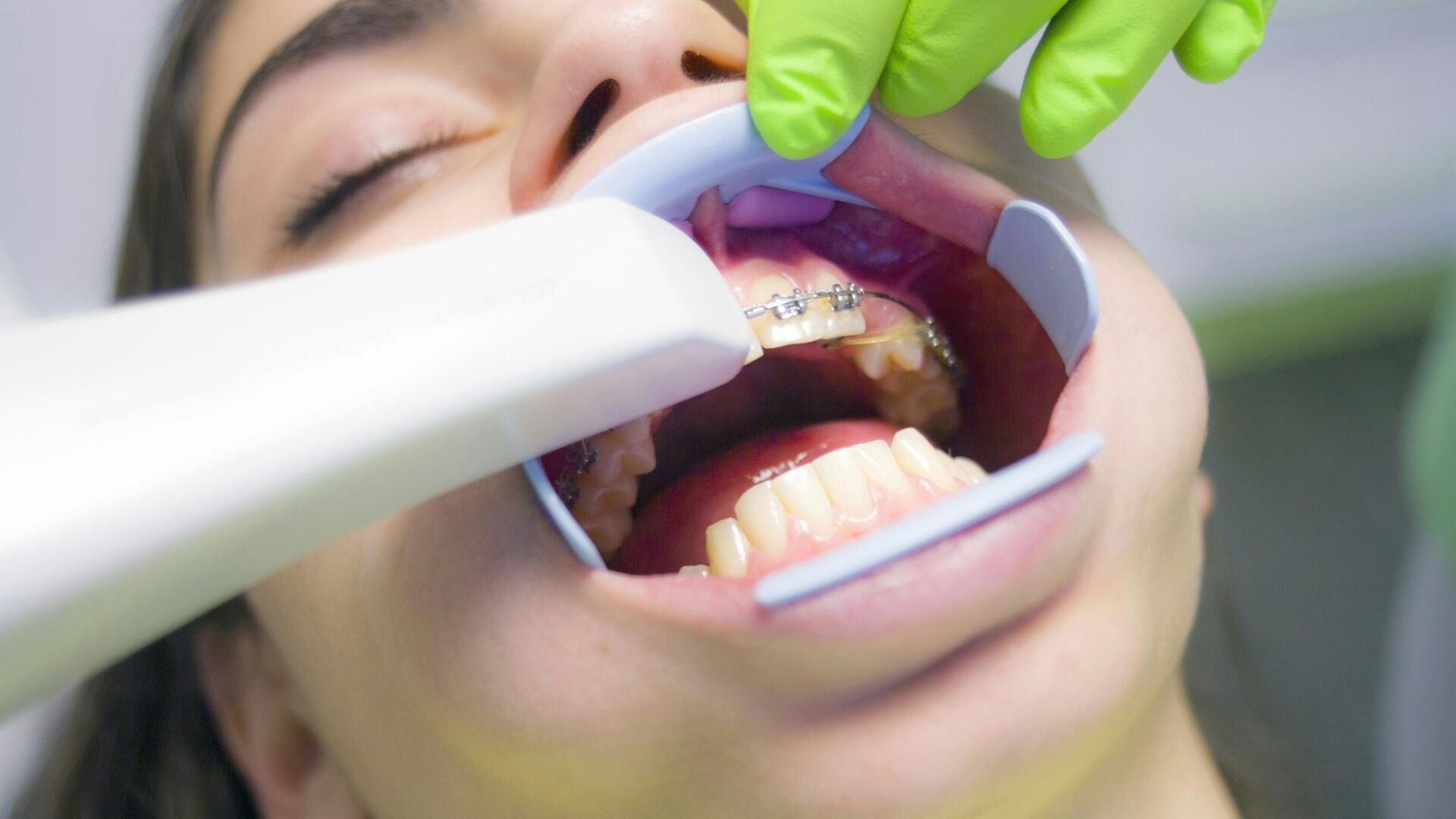 علماء روس يستخدمون الذكاء الاصطناعي لتشخيص الأسنان عن طريق الابتسامة