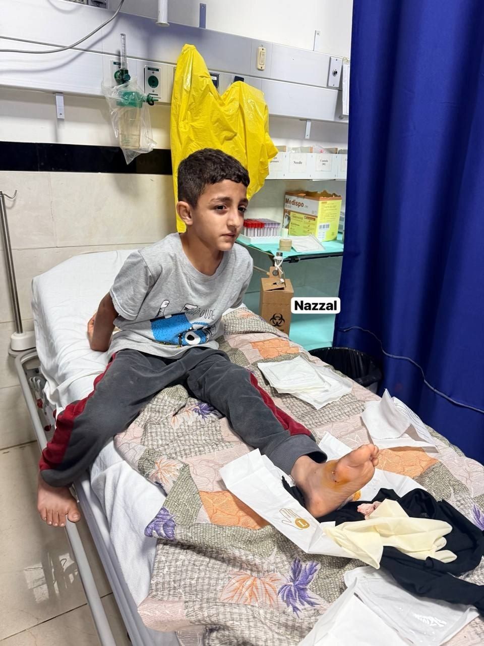 العدو الصهيوني يصيب طفلا فلسطينيا في قلقيلية