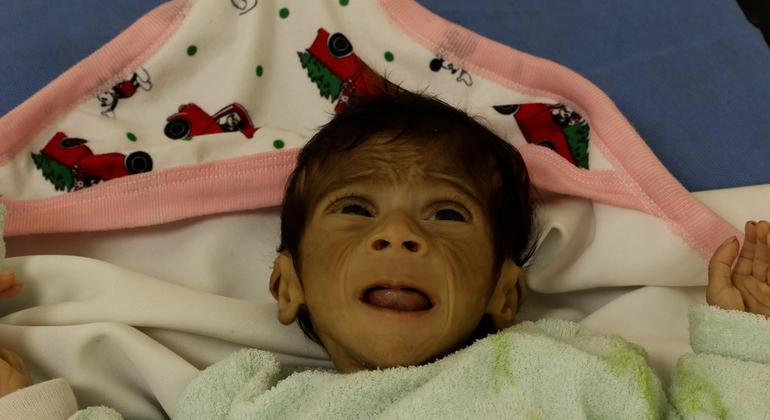 أطباء بلا حدود: التجويع يفاقم سوء التغذية لأطفال غزة ولم نشهد كارثة إنسانية بهذا الحجم من قبل