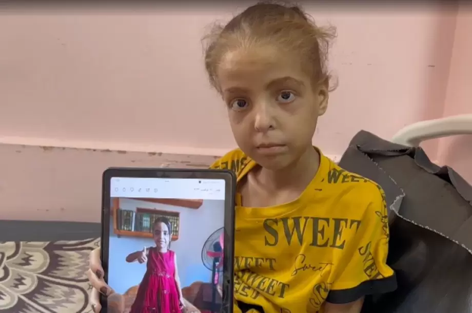 من 48 إلى 18 كيلوغرامًا.. رحلة انهيار جسد الطفلة هدى جراء الجوع في غزة