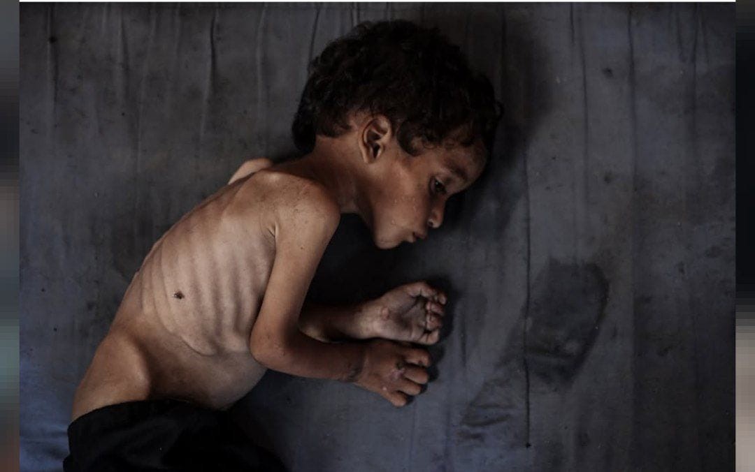 أمين عام الأمم المتحدة: سكان غزة يواجهون كارثة إنسانية بأبعاد مروعة