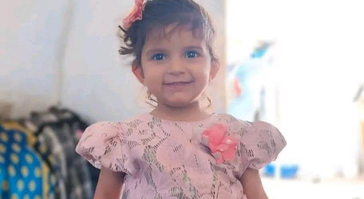 استشهاد طفلة فلسطينية من غزة متأثرة بإصابتها في قصف سابق