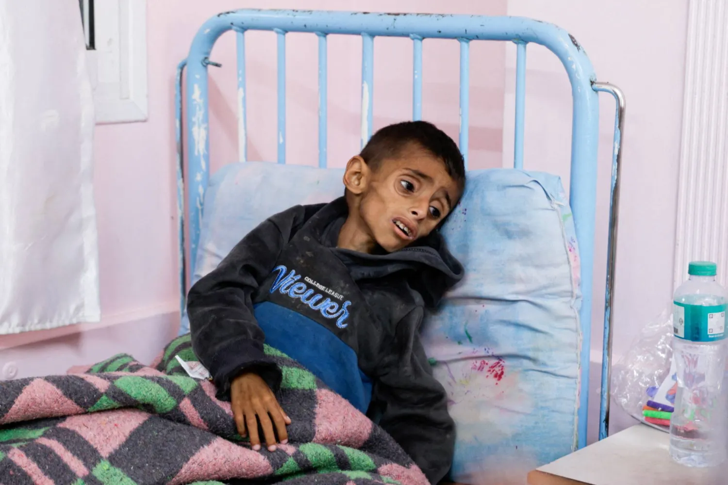 اليونيسف تحذر من تسارع خطير في سوء التغذية الحاد بين أطفال غزة