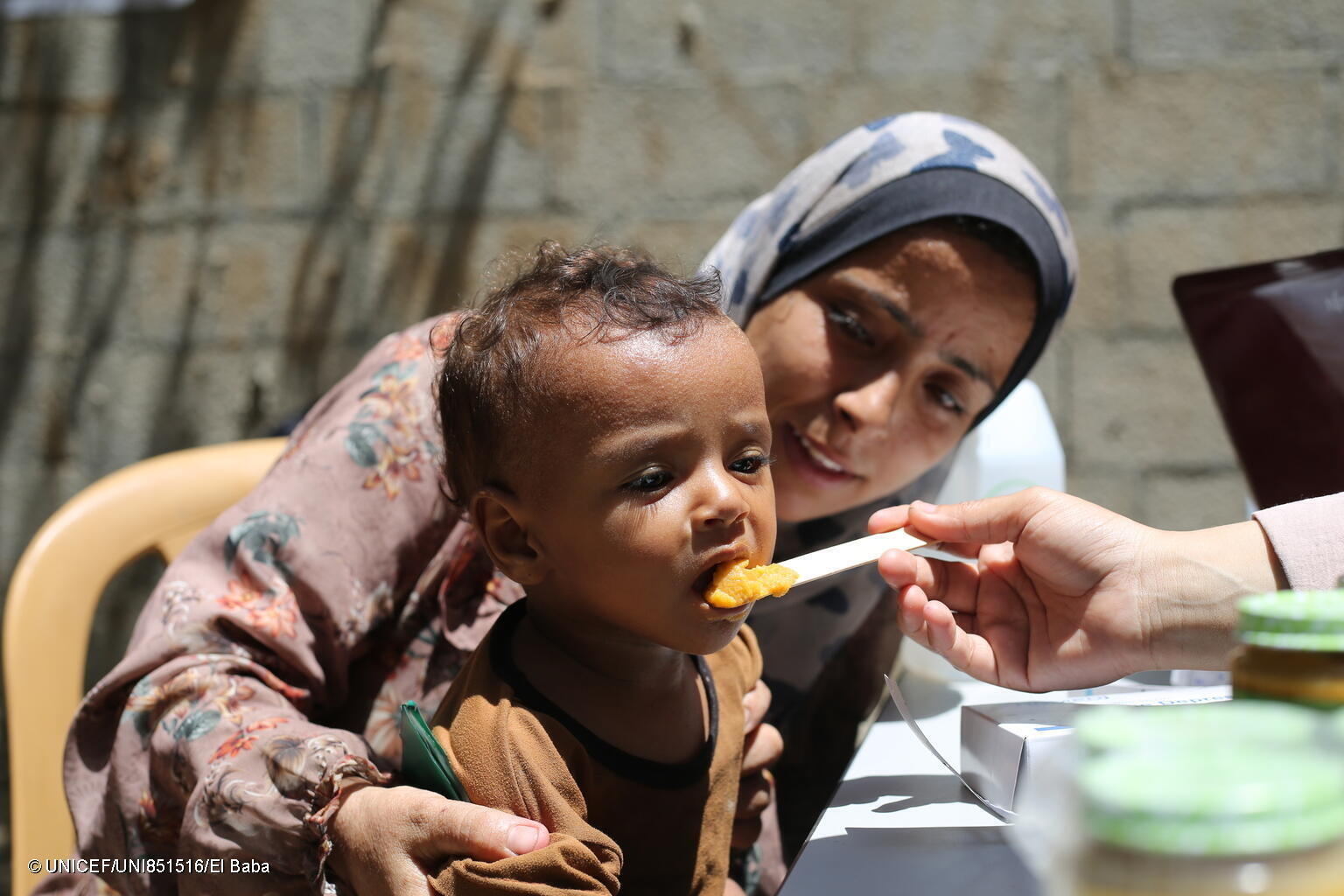 الأمم المتحدة: أكثر من 320 ألف طفل دون الخامسة في غزة معرضون لسوء التغذية الحاد