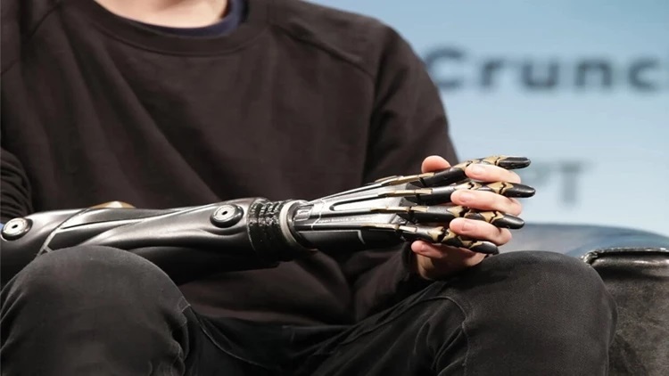 علماء روس يبتكرون تقنية فريدة من نوعها ترفع حساسية الأطراف الاصطناعية السيبرانية علماء روس يبتكرون تقنية فريدة من نوعها ترفع حساسية الأطراف الاصطناعية السيبرانية