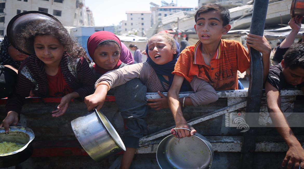 4 وفيات بينهم طفلان نتيجة المجاعة وسوء التغذية خلال الساعات الـ24 الماضية