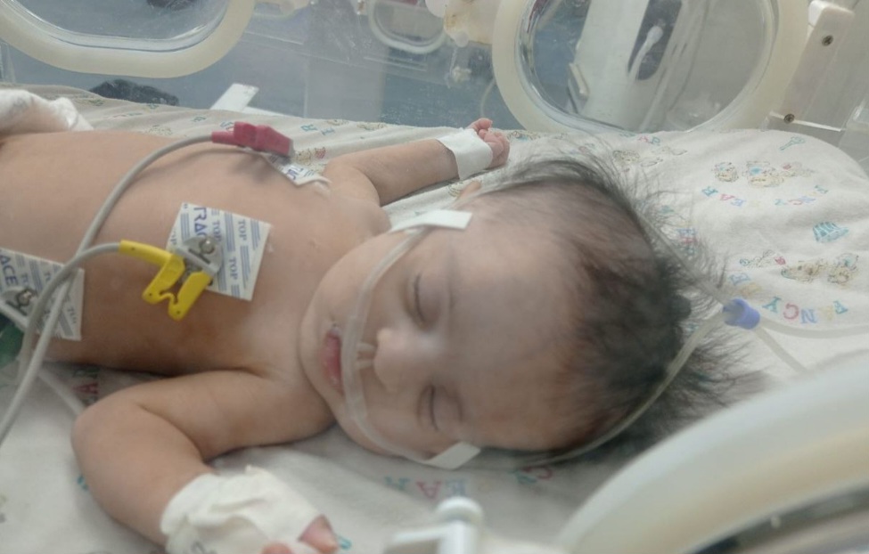 رضيعة بغزة تصارع الموت وسط عجز المنظومة الصحية وانتظار فتح المعابر 