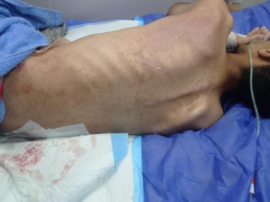 ثمانية أشهر من الوجع.. "نبيل أبو جبر" الغزّاوي بين الألم والانتظار القاسي