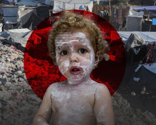 "صحة غزة" تحذر من تفشٍ مقلق للجدري واليرقان بمخيمات النزوح