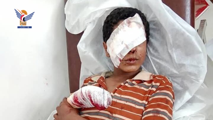 مركز التعامل مع الألغام: 10,689 شهيدًا وجريحًا ضحايا مخلفات الحرب والقنابل العنقودية حتى ديسمبر 2023