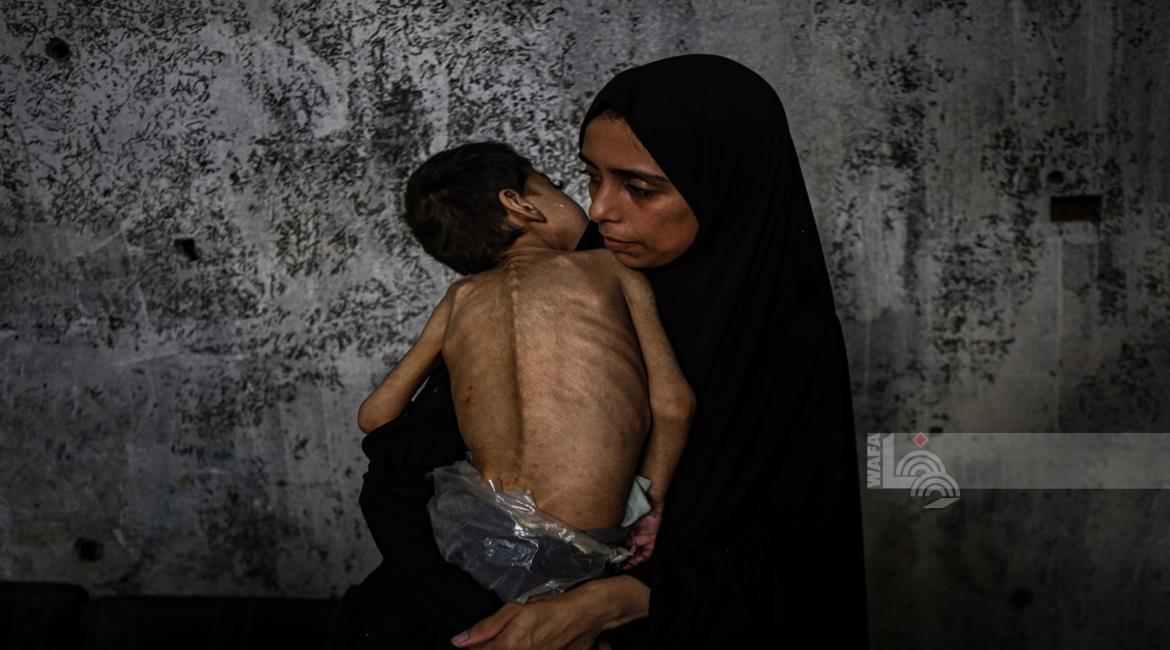 4 وفيات نتيجة المجاعة وسوء التغذية خلال الـ24 ساعة الماضية في قطاع غزة