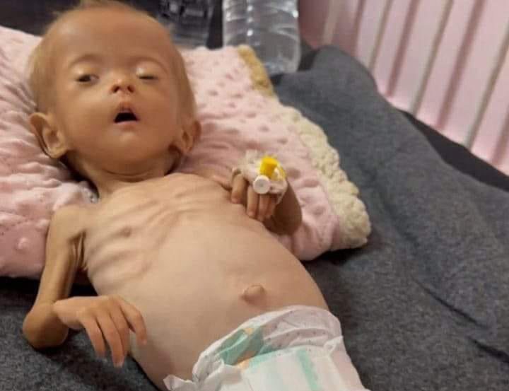 "صحة غزة": وفاة خمس حالات خلال الـ24 ساعة الماضية نتيجة المجاعة "صحة غزة": وفاة خمس حالات خلال الـ24 ساعة الماضية نتيجة المجاعة