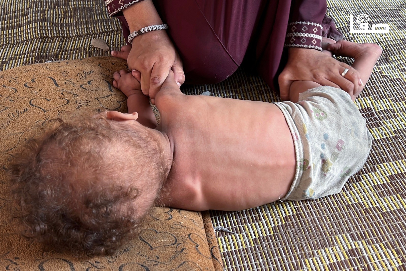 "الصحة "بغزة: تسجيل ست حالات وفاة بسبب المجاعة خلال الـ24 ساعة الماضية