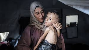 "الصحة بغزة":تسجيل خمس حالات وفاة جديدة نتيجة المجاعة خلال الـ24 ساعة الماضية  "الصحة بغزة":تسجيل خمس حالات وفاة جديدة نتيجة المجاعة خلال الـ24 ساعة الماضية