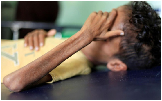 اليمن: “هنا الجحيم”! أسوأ مكان في العالم والوضع هناك مثل “الجحيم”.