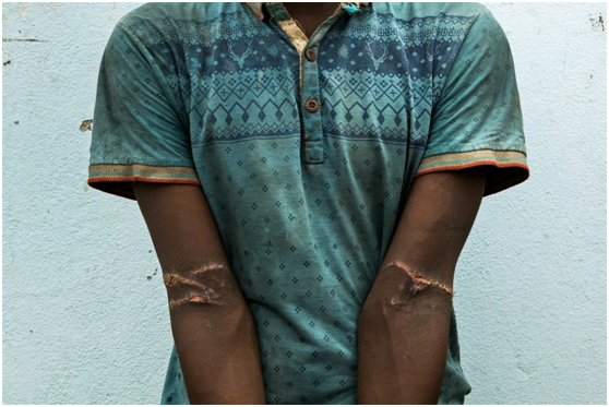 الكشف عن سجون الإمارات السرية في اليمن مهمة قد تكون قاتلة.. حكاية صحفية دفعت ثمناً باهظاً