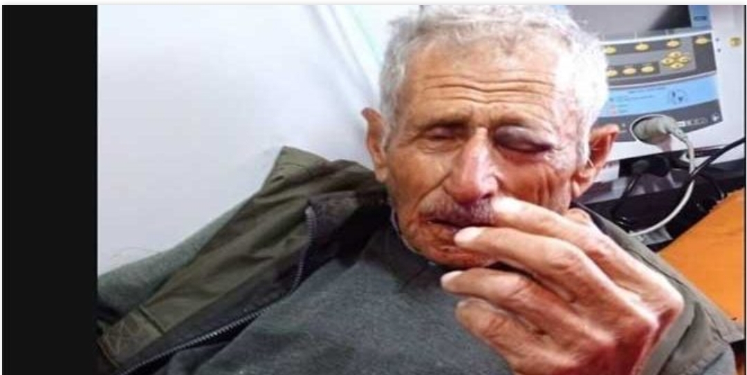 إصابة مسن فلسطيني جراء اعتداء مستوطنين عليه في طولكرم
