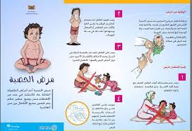وزير الصحة: لا علاج لأمراض الطفولة القاتلة إلا بالتحصين