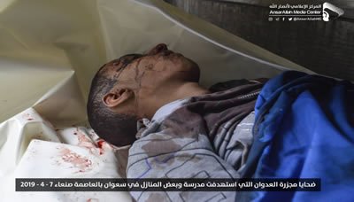 المؤتمر الشعبي يعتبر جريمة العدوان في سعوان تحدياً للجهود الدولية