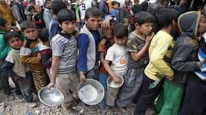 اليمن… حرب الجوع اليمن… حرب الجوع