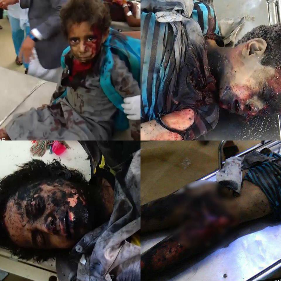 ست نساء وطفل ضحايا جرائم مرتزقة العدوان في الحديدة والضالع وتعز