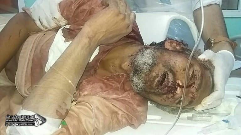 استشهاد 3 مواطنين وإصابة 20 آخرين بقصف مدفعي سعودي على صعدة