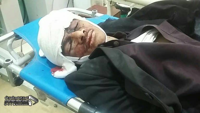 ارتفاع حصيلة مجزرة العدوان في صعدة إلى 36 شهيدا وجريحا
