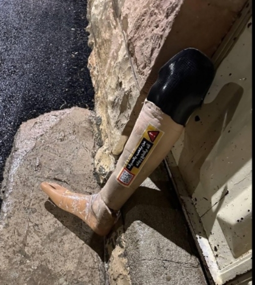 العدو الصهيوني يرهب اهالي حزما بوضع أطرافا صناعيا مع رسائل تحذير 