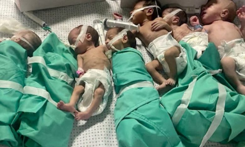 الأورومتوسطي: وفاة طفل بسبب نقص الغذاء في مستشفى الشفاء بغزة