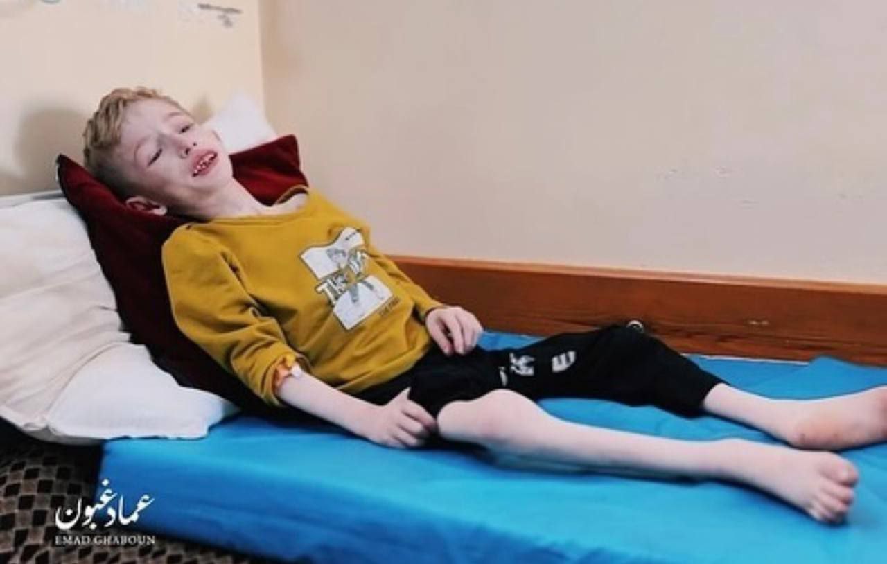 “الأغذية العالمي” : أكثر من نصف مليون إنسان بغزة يعانون مستوياتٍ كارثيةٍ من الجوع