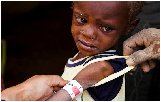 الحرب الاقتصادية على اليمن