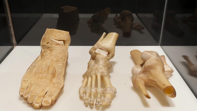 ابتكار “أسمنت” لترميم شقوق العظام ابتكار “أسمنت” لترميم شقوق العظام