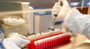 وزير الصحة الروسي يعلن عن موعد نشر الأبحاث المتعلقة بأول لقاح ضد “كورونا”