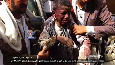 المنظمات الدولية العاملة في المجال الصحي باليمن تدين جريمة استهداف الاطفال بضحيان