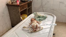 استشهاد رضيع فلسطيني بسب سوء التغذية والجوع بغزة