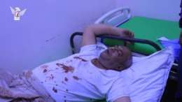 وزارة الصحة: ارتفاع حصيلة جريمتي استهداف ميناء الحديدة ومصنع باجل إلى 43 شهيداً وجريحاً