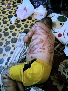 السلطة المحلية في إب تدين جريمة تعذيب وقتل المواطن محمد مهدي من قبل المرتزقة