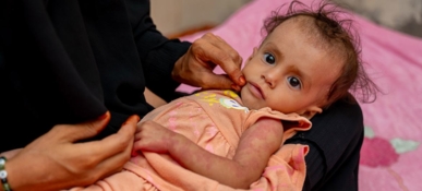 تقرير أممي :أكثر من 295 مليون شخص عانوا من الجوع الحاد العام الماضي