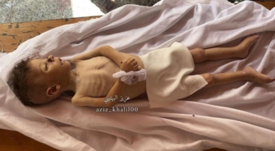 ​استشهاد الطفل الفلسطيني سيف حلس بسبب الجوع وسوء التغذية في غزة