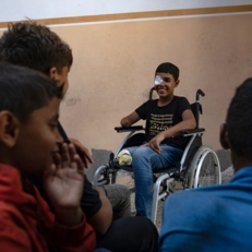 البرش: البتر أصبح خيارا وحيدا لأطباء غزة لإنقاذ المصابين